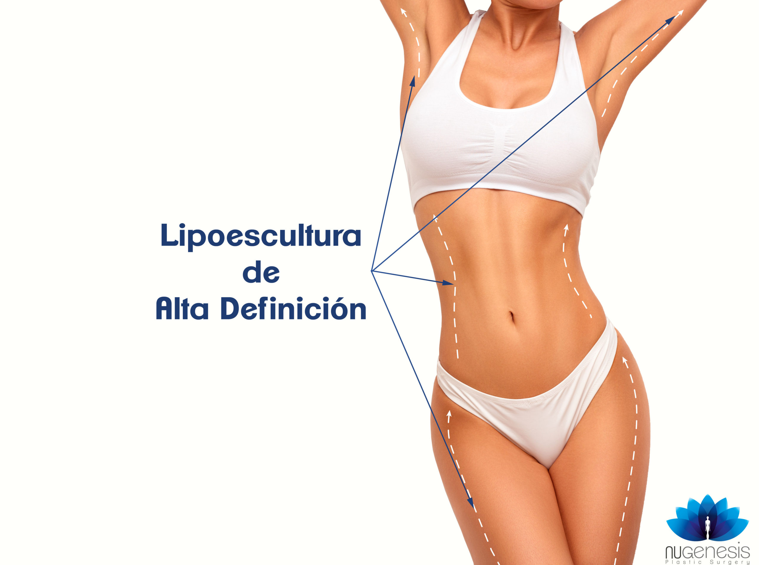 Lipoescultura Alta Definicion NuGenesis Plastic Surgery Clinica de
